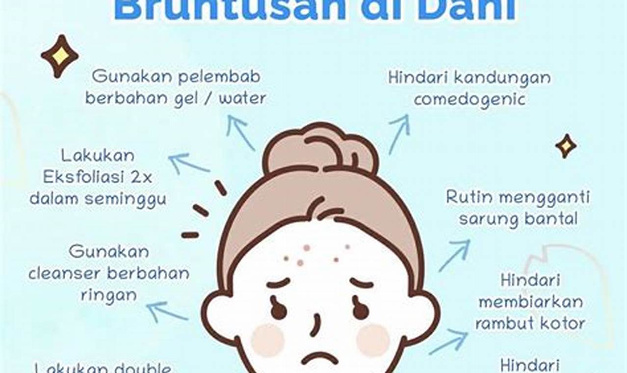 Cara Mengatasi Bruntusan Di Dahi